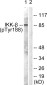 Phospho-IKK beta (Tyr188) Rabbit pAb ABZ4481