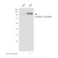 Phospho-HDAC5 (Ser498) Rabbit pAb ABZ4490