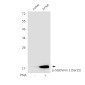 Phospho-Stathmin 1 (Ser25) Rabbit pAb ABZ4491