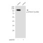 Phospho-EPHA4 (Tyr596) Rabbit pAb ABZ4497