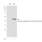 Phospho-GSK3(alpha + beta)(Tyr279/Tyr216) Rabbit pAb ABZ4509