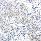 Phospho-Synapsin I (Ser9) Rabbit mAb ABZ4510