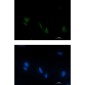 Phospho-RSK4 (Ser232) Rabbit mAb ABZ4511