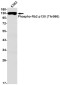 Phospho-Rb2 p130 (Thr986) Rabbit mAb ABZ4513