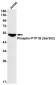 Phospho-PTP1B (Ser352) Rabbit mAb ABZ4514