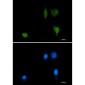 Phospho-delta 1 Catenin (Tyr228) Rabbit mAb ABZ4516