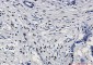 Phospho-c-Jun (Ser63) Rabbit mAb ABZ4520