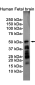 Phospho-Tau (Ser198) Rabbit mAb ABZ4521