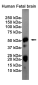 Phospho-Tau (Ser404) Rabbit mAb ABZ4524