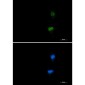 Phospho-ATF2 (Thr71) Rabbit mAb ABZ4526