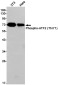 Phospho-ATF2 (Thr71) Rabbit mAb ABZ4526