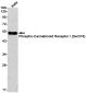 Phospho-Cannabinoid Receptor I (Ser316) Rabbit mAb ABZ4528