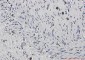 Phospho-CREB (Ser133) Rabbit mAb ABZ4533