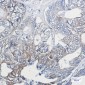 Phospho-Cytokeratin 8 (Ser23) Rabbit mAb ABZ4534