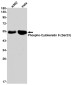 Phospho-Cytokeratin 8 (Ser23) Rabbit mAb ABZ4534