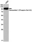 Phospho-Dishevelled 2 (Ser143) Rabbit mAb ABZ4535