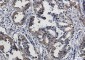 Phospho-eIF4E (Ser209) Rabbit mAb ABZ4536