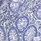 Phospho-Glycogen synthase 1/GYS1(Ser641) Rabbit mAb ABZ4537