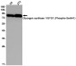 Phospho-Glycogen synthase 1/GYS1(Ser641) Rabbit mAb ABZ4537