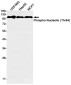 Phospho-Nucleolin (Thr84) Rabbit mAb ABZ4540