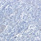 Phospho-PRKAR2A (Ser99) Rabbit mAb ABZ4542