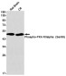 Phospho-PRKAR2A (Ser99) Rabbit mAb ABZ4542