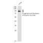 Phospho-Progesterone Receptor (Ser190) Rabbit mAb ABZ4544
