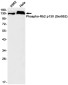 Phospho-Rb2 p130 (Ser952) Rabbit mAb ABZ4547