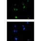 Phospho-Amyloid Precursor Protein (Thr743)  Rabbit mAb ABZ4553