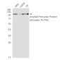 Phospho-Amyloid Precursor Protein (Thr743)  Rabbit mAb ABZ4553