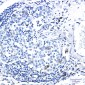 Phospho-CDK1/2 (Thr14) Rabbit mAb ABZ4555