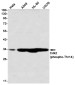 Phospho-CDK2 (Thr14) Rabbit mAb ABZ4556