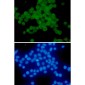 Phospho-delta 1 Catenin (Thr916) Rabbit mAb ABZ4558