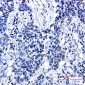 Phospho-delta 1 Catenin (Thr916) Rabbit mAb ABZ4558