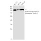Phospho-delta 1 Catenin (Thr916) Rabbit mAb ABZ4558