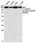 Phospho-E Cadherin (Ser838/Ser840) Rabbit mAb ABZ4559