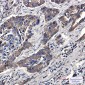Phospho-eIF4B (Ser406) Rabbit mAb ABZ4561