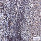 Phospho-Ezrin/Radixin/Moesin (Thr567/Thr564/Thr558) Rabbit mAb ABZ4562