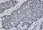 Phospho-GATA3 (Ser308) Rabbit mAb ABZ4564