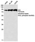 Phospho-Hormone Sensitive Lipase/HSL (Ser855) Rabbit mAb ABZ4565