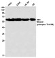 Phospho-Moesin (Thr558) Rabbit mAb ABZ4568