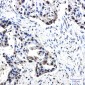 Phospho-Nucleophosmin (Thr199) Rabbit mAb ABZ4569