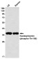 Phospho-Nucleophosmin (Thr199) Rabbit mAb ABZ4569