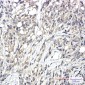 Phospho-PKC zeta/lambda (Thr410/Thr412) Rabbit mAb ABZ4570