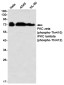 Phospho-PKC zeta/lambda (Thr410/Thr412) Rabbit mAb ABZ4570