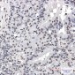 Phospho-PML Protein (Ser518) Rabbit mAb ABZ4571