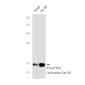 Phospho-PTS (Ser19) Rabbit mAb ABZ4573