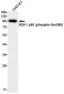 Phospho-RSK1 p90 (Ser380) Rabbit mAb ABZ4578