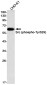 Phospho-Src (Tyr529) Rabbit mAb ABZ4579