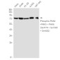 Phospho-PAK4/5/6 (Ser474/Ser560/Ser602) Rabbit mAb ABZ4580